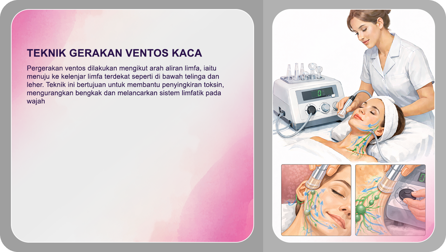 Teknik Gerakan Ventos Kaca